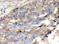 Anti-Cofilin Picoband Antibody